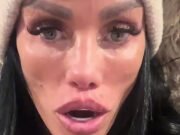 Katie Price dice ‘mira, estoy arruinando mis labios’ mientras muestra su puchero desinflado después de que le disolvieran los rellenos.