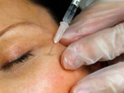 La FDA advierte a los sitios web que venden Botox no aprobado con fines cosméticos