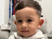 Niño de 3 años de Morgan Hill se recupera de quemaduras tras explosión de fogata – The Mercury News