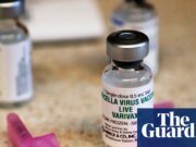 Los niños en el Reino Unido recibirán la vacuna contra el sarampión, las paperas y la rubéola junto con la vacuna contra la varicela. Vacunas e inmunizaciones