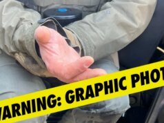 Subsecretario de Seguridad Nacional afirma que alborotadores en Minnesota le cortaron los dedos a un agente