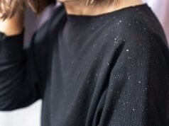 Cómo un ataque repentino de caspa puede ser el primer signo de pérdida de cabello: perjudicial, ya que cada vez más personas sufrimos de cuero cabelludo escamoso