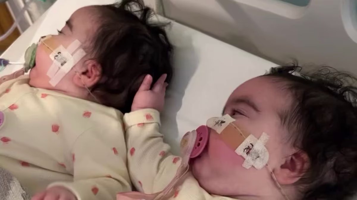 Jessie Nelson reveló que sus hijas gemelas, de 9 meses, están siendo tratadas en el Great Ormond Street Hospital mientras compartió imágenes desgarradoras de sus férulas en las piernas a juego en medio de su tratamiento en curso para la AME.