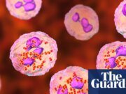 Los expertos consideran ampliar la elegibilidad para la vacuna contra la meningitis después del brote de Kent Meningitis