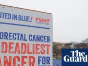 Las tasas de cáncer de colon aumentan a medida que los menores de 45 años en EE. UU. luchan por obtener un seguro de salud en EE. UU.