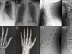 Las radiografías deepfake son tan reales que ni siquiera los médicos pueden notar la diferencia