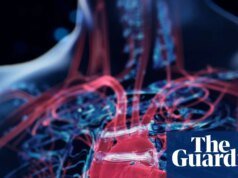 Heart Disease desarrolló una herramienta de inteligencia artificial cinco años antes de que los científicos detectaran el riesgo de insuficiencia cardíaca
