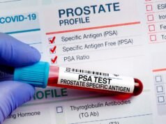 Miles de hombres corren el riesgo de ser condenados a una muerte evitable mientras los asesores gubernamentales rechazan los llamamientos para un importante programa de detección del cáncer de próstata.