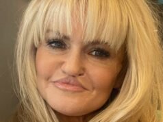 Danniella Westbrook compartió la última foto de su rostro mientras se prepara para una cirugía correctiva en sus labios.