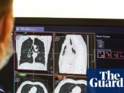 El NHS gasta una cifra récord de 241 millones de libras esterlinas en subcontratar análisis de escaneo a empresas privadas NHS