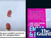 La imagen de los ‘gemelos’ utilizada por los activistas antiaborto parece mostrar petauros del azúcar.