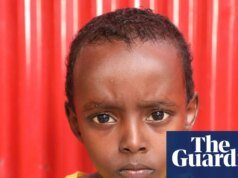 Abdikadir, de siete años, resultó herido en un ataque aéreo estadounidense. Sin la operación de 750 dólares, podría perder su capacidad de caminar por Somalia