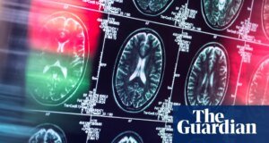 Los antidepresivos y antipsicóticos pueden funcionar como una alternativa a los opioides, según muestran estudios Opioides
