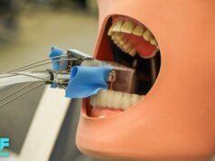 Cómo los robots dentales pueden cambiar los procedimientos de coronas